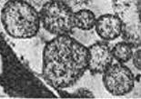 phytoplasme